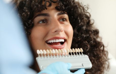 Signs It’s Time to Replace Your Dental Veneers